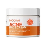 Creme Facial Moyam para Acne 100g